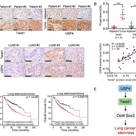 High Expression Of Usp Is Positively Correlated With Twist And