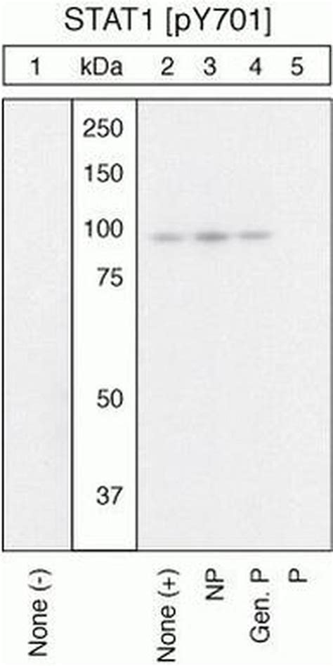 Phospho Stat1 Tyr701 Polyclonal Antibody 44 376g