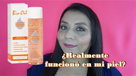 Reseña Final TODO SOBRE BIO OIL Cómo eliminar manchas cicatrices y