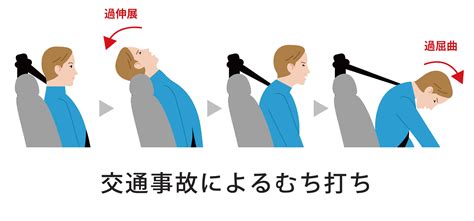 【首の片側が痛い】右側 Or 左側のみ痛い場合の原因と3つの対処法をわかりやすく解説！ 株式会社リハサク