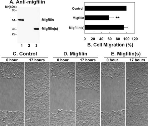 Overexpression Of Migfilin But Not That Of Migfilin S Reduces MDCK