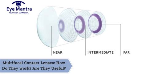 Multifocal Contact Lenses : How Do They work? Are They Useful?