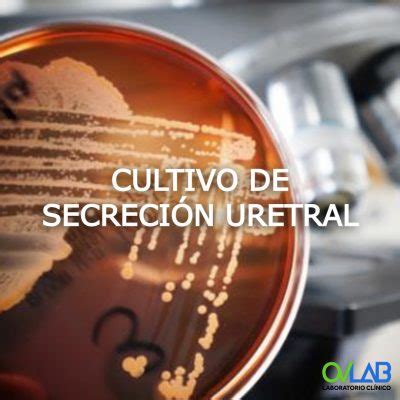 Cryptococcus Neoformans En Lcr Tinta China Ovlab O V Laboratorios