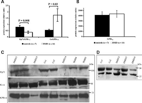 Expression Of Dystrophin Isoform Dp Gs A Gpib A And B Actin In