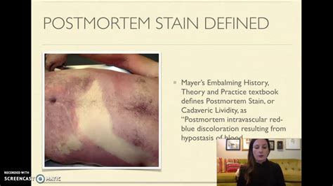 Postmortem Stain And Postmortem Caloricity Youtube