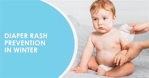 "Winter Diaper Rash Prevention: Essential Tips for Protecting Your Baby ...