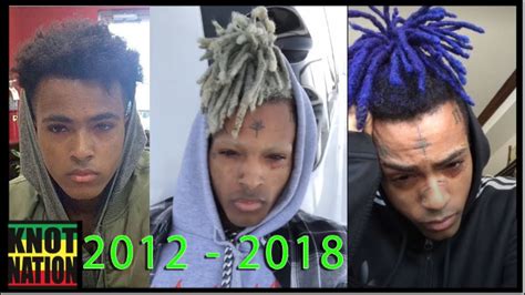 Xxxtentacion Dreads Hairstyles