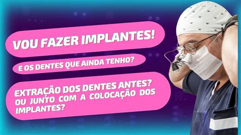 Vou Fazer Implantes Mas Quando Extrair Os Dentes Que Ainda Tenho