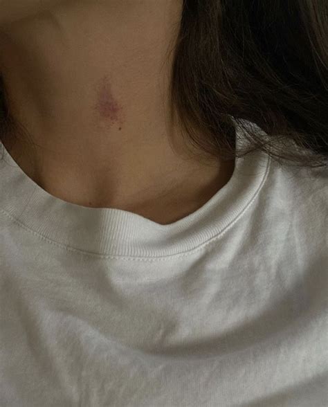 Pin By Ruth Mayma On Kim In 2022 Hickey On Girls Hickies Neck Aesthetic Korean Hickies