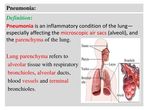 Ppt Pneumonia Powerpoint Presentation Free Download Id 2787113