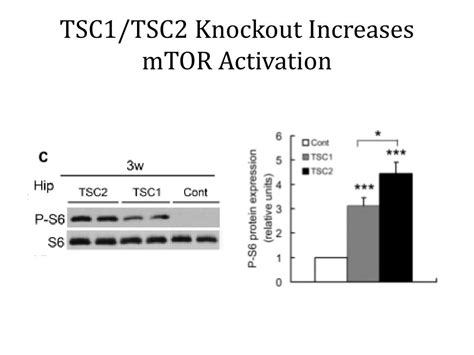 tsc complex  tuberous sclerosis powerpoint