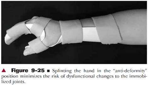 Applied Clinical Anatomy Pathologies Of The Wrist Hand Flashcards