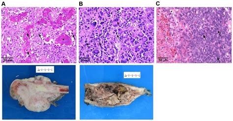 Pathological Diagnosis Of Sarcomas Histopathology Slides Of The