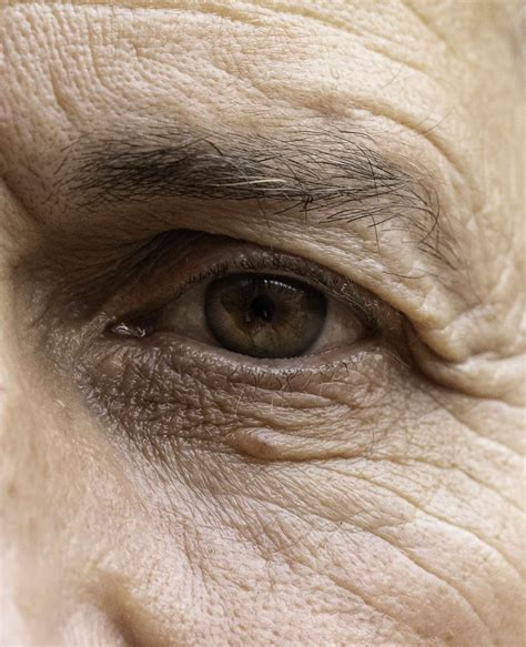 eyelid tightening  eyelid blepharoplasty face restoration