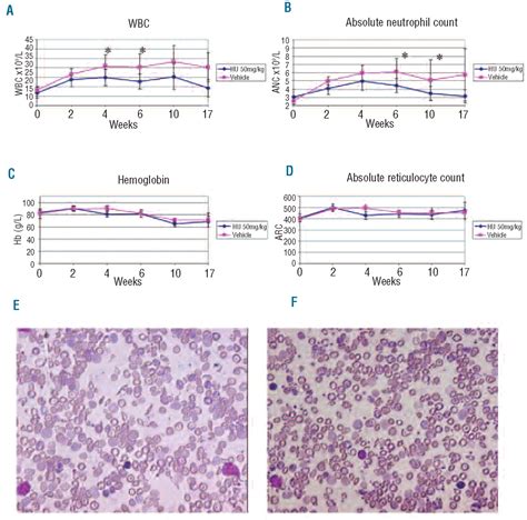 Hydroxyurea Therapy Requires Hbf Induction For Clinical Benefit In A Sickle Cell Mouse Model