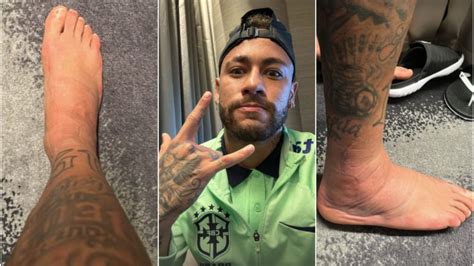 Alvo De Ironias Por Les O Neymar Mostra Tornozelo Inchado