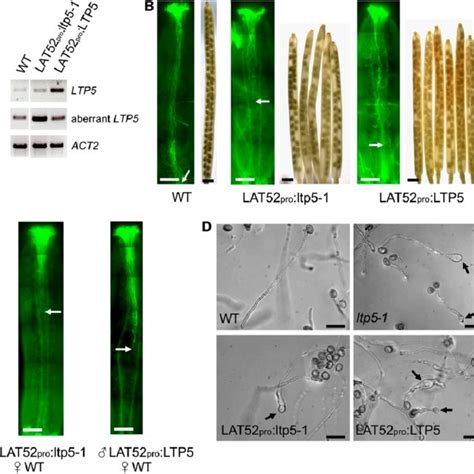 Arabidopsis Ltp Is Present In Pollen Pollen Tubes And The Pistil Tt