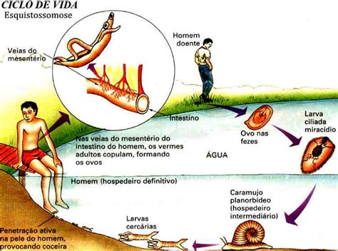 VERMINOSES