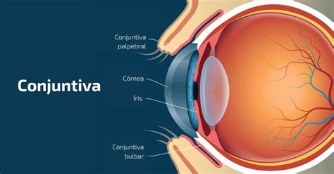 Conjuntiva o que é função principais doenças e irritações