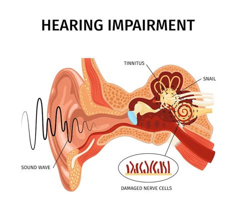 Comprehensive Guide To Understanding Tinnitus Symptoms Causes And