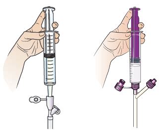 Crimping Feeding Tube to Attach Syringes - Smith Whanderharty