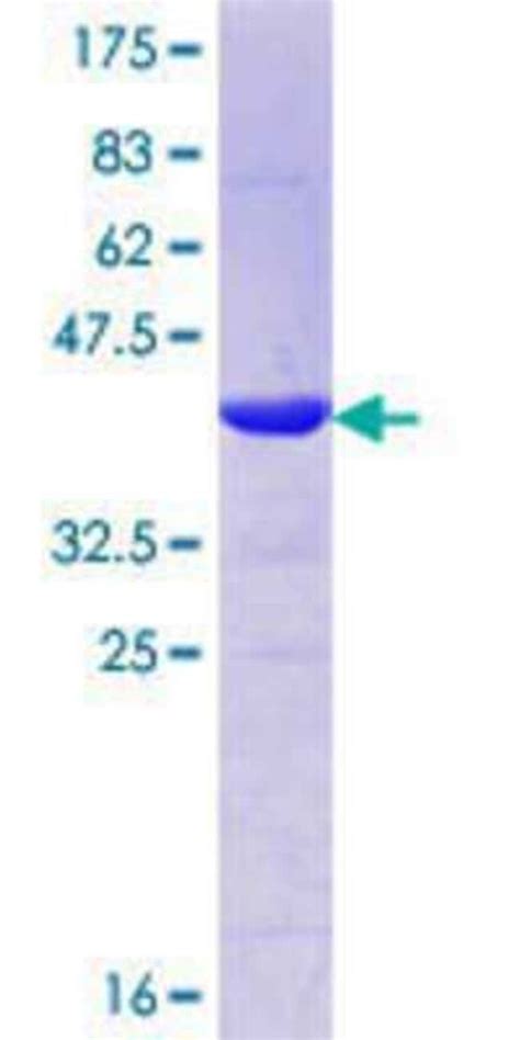 Novus Biologicals Recombinant Human mLXIP GST N Term Protein 10 μg