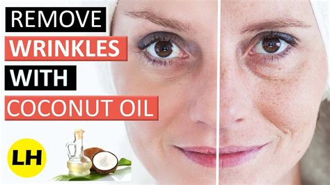 How To Get Rid Of Wrinkles Naturally Using Coconut Oil Easy Anti