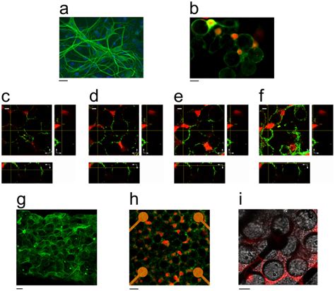 A Mature Hippocampal Neurons 4th Week In Vitro Cultured On A