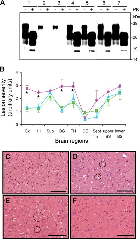 Characterization Of PrP Sc And Brain Histopathology Of RShaPrP