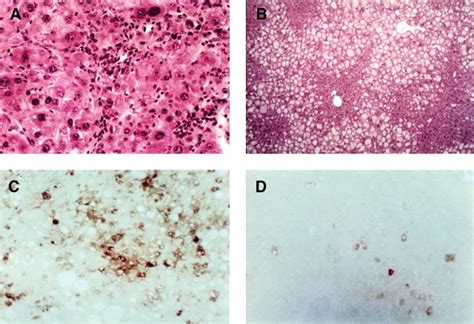 Diminished Oval Cell Response In Tnfr1 Ko Mice Hematoxylin And Eosin