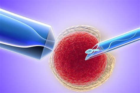 Icsi Your Step By Step Overview Fertility Treatments Intracytoplasmic By Australian