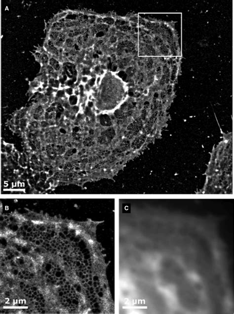 Single Molecule Localization Microscopy Reveals Nanopores In The