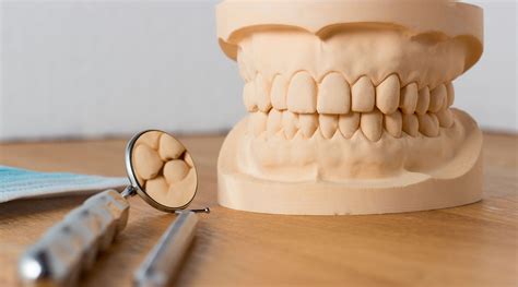 Chromo Instituto de Radiologia Odontológica Modelo em Gesso