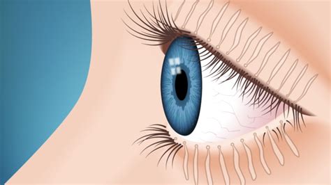 MEIBOMIAN-GLAND-PROBING-IN-THE-UK | Optometrist Paducah Kentucky, Eye ...