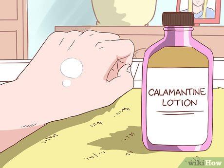 Ways To Handle An Eczema Flare Up Wikihow