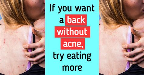 10 Tips To Get Rid Of Body Acne And Bring Back Your Confidence Bright