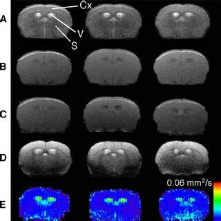 Conventional And Diffusion Weighted MRI Of Brain NCM And HP Mice Are