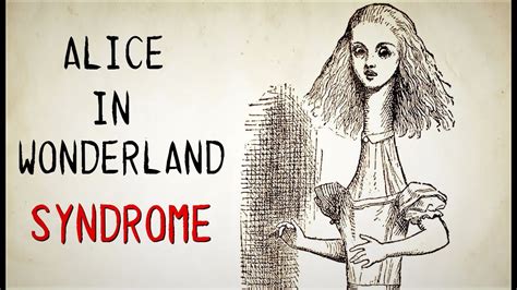 What Is Alice In Wonderland Syndrome Youtube