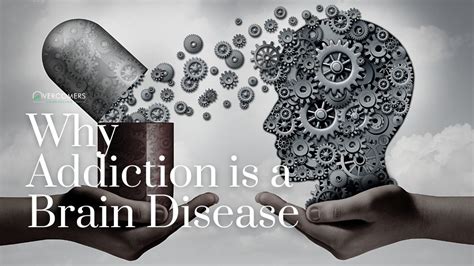 Why Addiction Is A Brain Disease