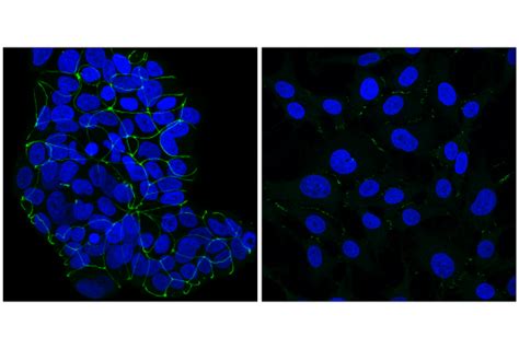 ZO 1 D6L1E Rabbit MAb Alexa Fluor 488 Conjugate Cell Signaling