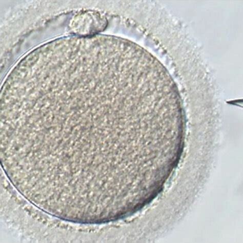 Images Of Icsi Procedure On Mature Mii Oocyte Extruded Polar Body At