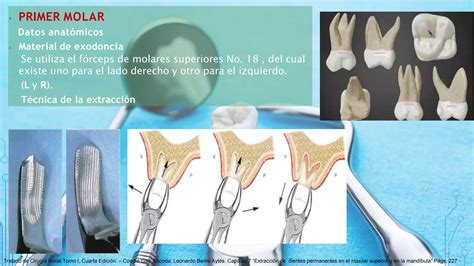 Piezas Dentales Y El Instrumental Correcto Para Su Exodoncia Adultospptx