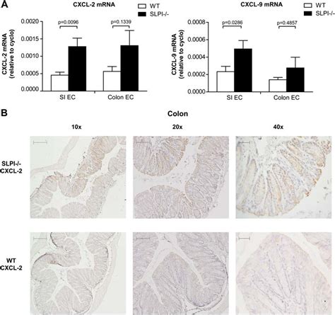 CXCL 2 And CXCL 9 Expression Is Spontaneously Enhanced In The