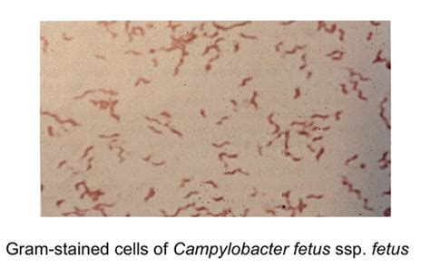 Ug Campylobacter Coxiella Aspergillus Wip Flashcards Quizlet