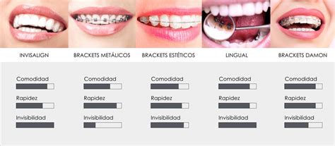 Qué tipo de ortodoncia elijo Diferencias Alvarado Dental Clinic