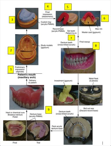 Removable Prosthesis And Acrylic Resins Flashcards Quizlet