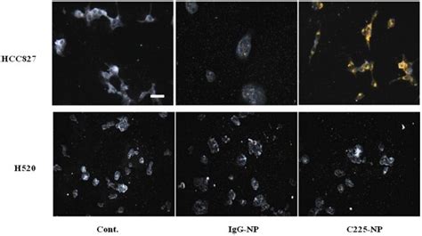 Hcc827 And H520 Cells Seeded On Chamber Slides Were Treated With Igg Np