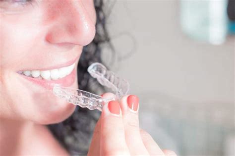 How Do You Clean Invisalign Retainers Trays