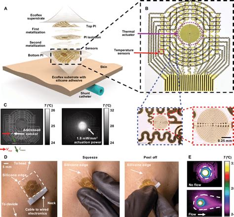 Soft Skin Mounted Wearable Device For Noninvasive Continuous Or