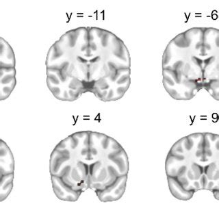 Brain Regions Showing Significant Activation Changes During The